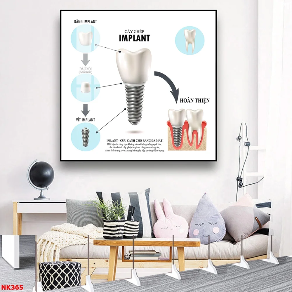 NK365 2 - Tranh treo tường tráng gương Trang trí Nha khoa Implant