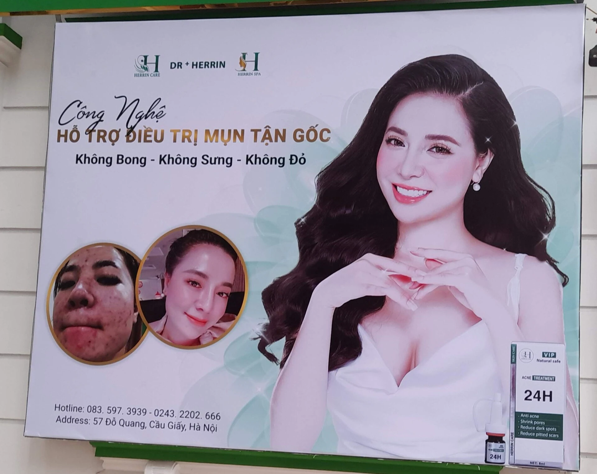 Mô tả: Oha Decor với đội ngũ chuyên nghiệp, sáng tạo cho thiết kế bạt quảng cáo Quy Nhơn Thiết Kế Bạt Quảng Cáo Quy Nhơn 2025